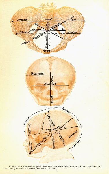 Vintage Newborn Fetal Skull Landmarks Chart Poster  